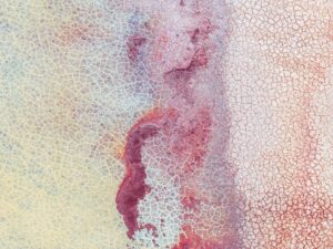 Exploring the Ethics of Quarantine and Isolation During Infectious Disease Crises