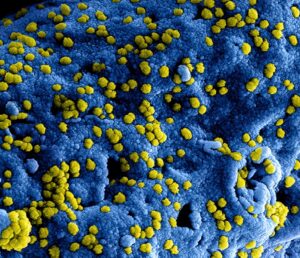 How Infections Can Trigger Autoimmune Diseases and Chronic Inflammatory Conditions