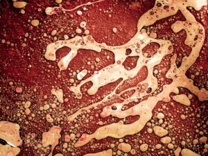 The Economic Costs of Widespread Infectious Disease Outbreaks and Global Response