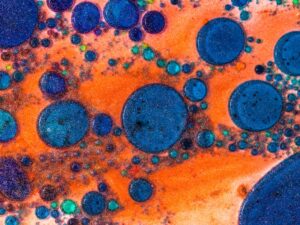 Understanding Hospital-Acquired Infections and Strategies to Prevent Their Spread